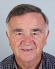 After Hair Transplant &nbsp;Front